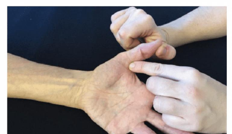 Лечение повреждения длинного разгибателя большого пальца кисти Длинные мышцы стоп